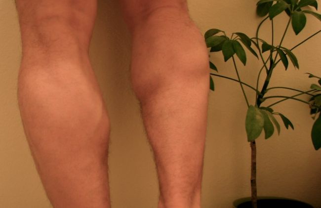 hinchazon-pantorrillas-piernas 